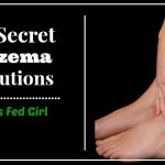 6 Secret Eczema Solutions