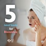 5 Natural Remedies for Blemishes